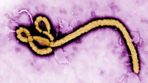 Ebola